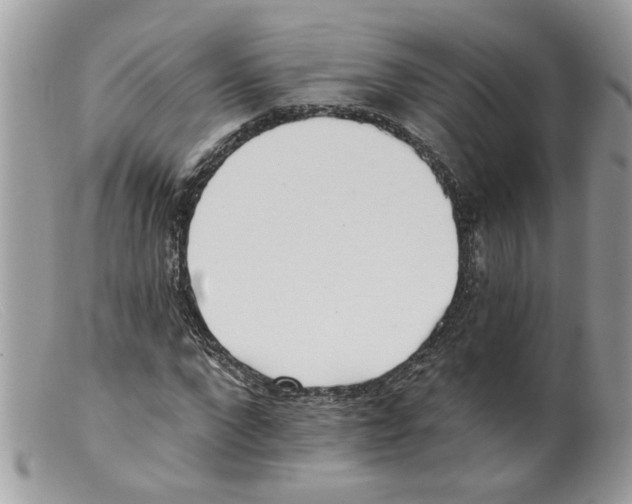 X0000098140872200805151138