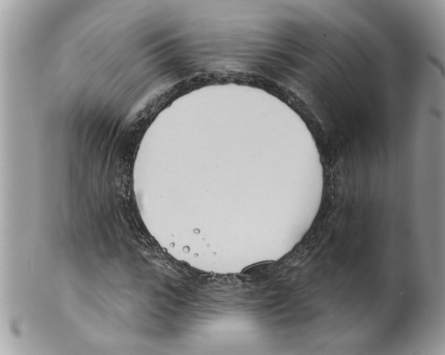 X0000098140919200805151136