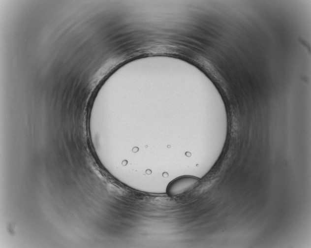 X0000098140986200805151136