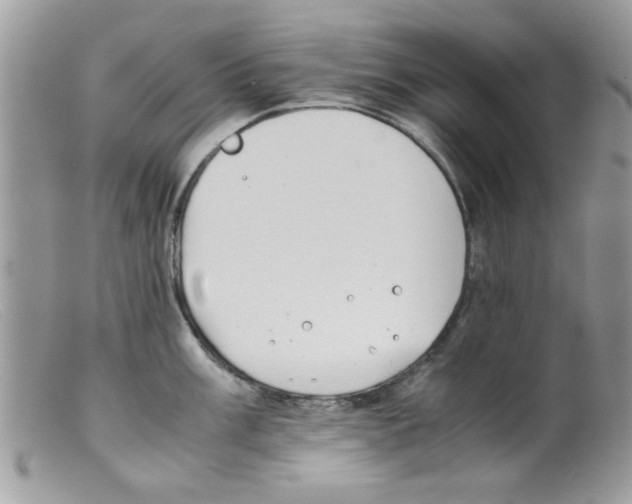 X0000098141003200805151135