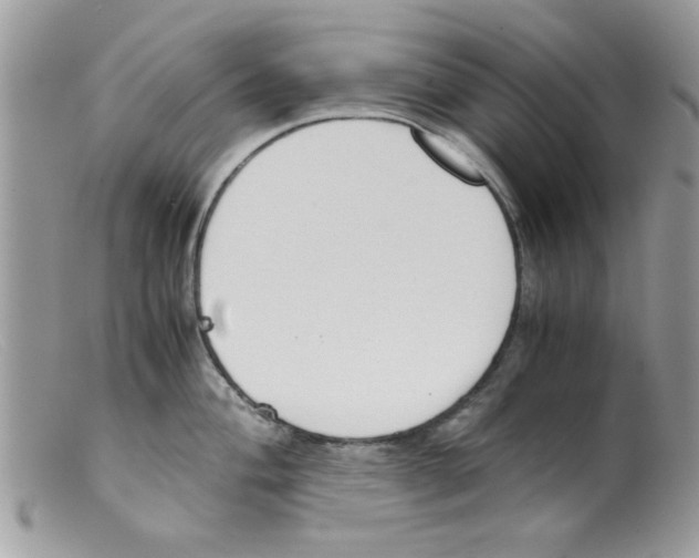 X0000098141004200805151135