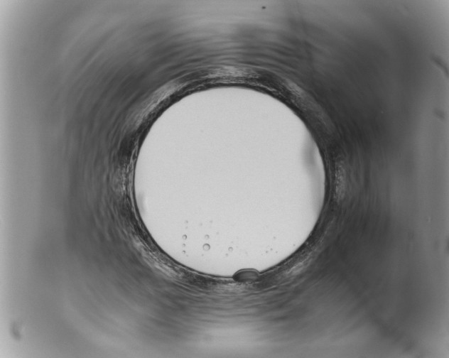 X0000098141017200805151135