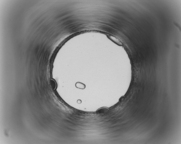 X0000098141076200805151134