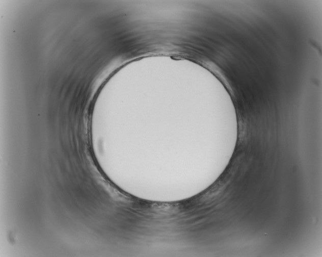 X0000098141099200805151134