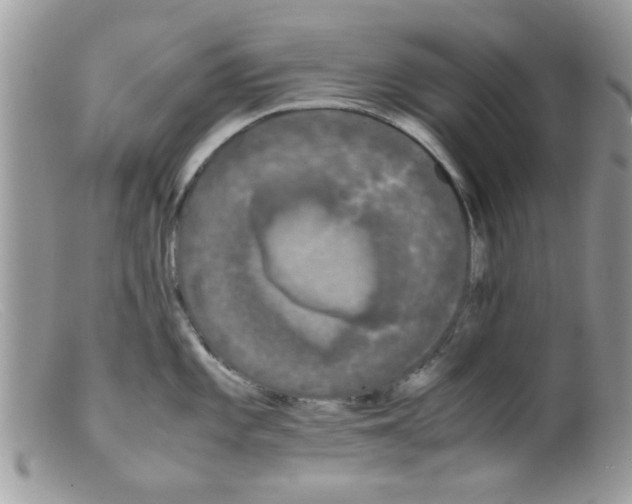 X0000098141101200805151134