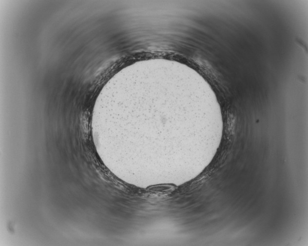 X0000098141110200805151133