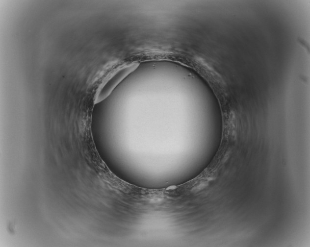 X0000098141157200805151133