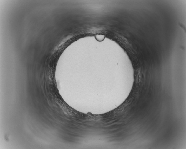 X0000098141158200805151133