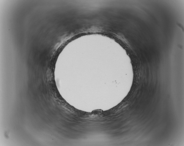 X0000098141160200805151133