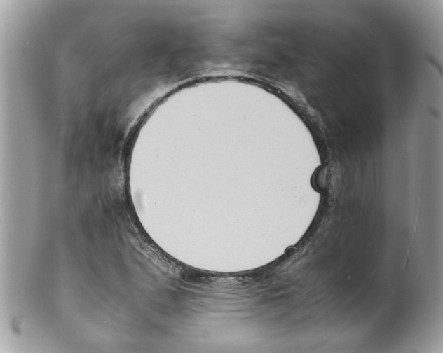 X0000098141167200805151133