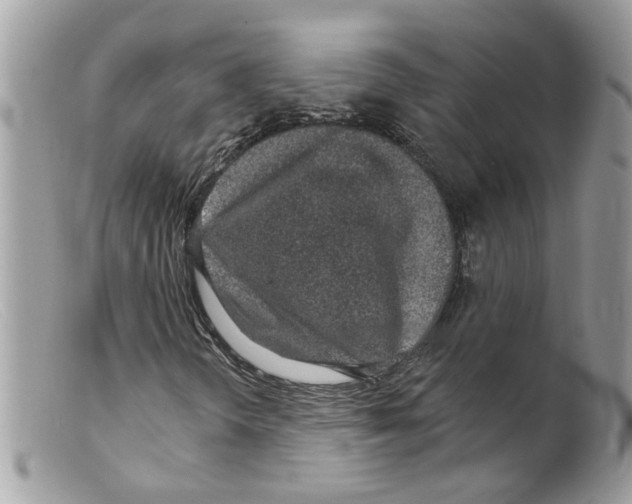 X0000098141298200805151130