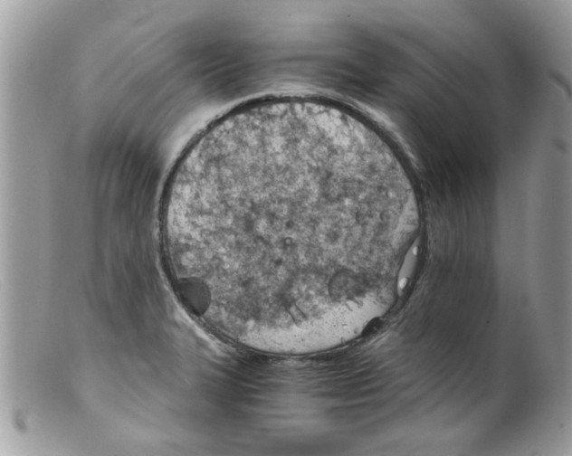 X0000098141327200805151130