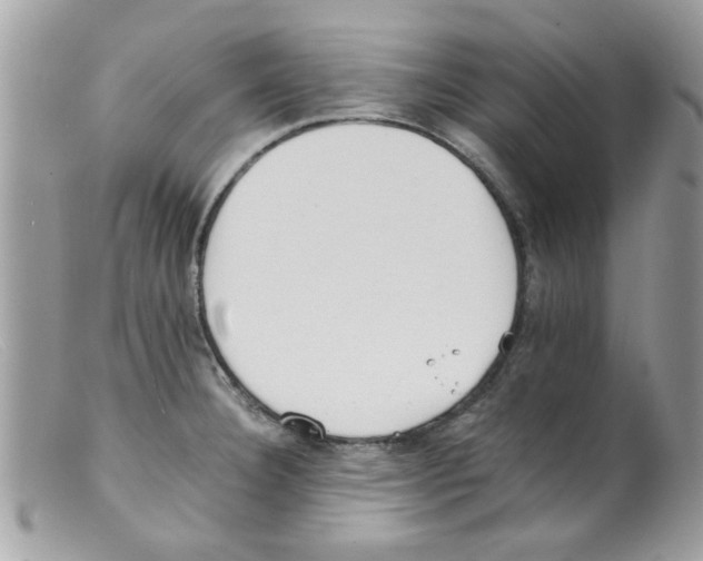 X0000098141332200805151130