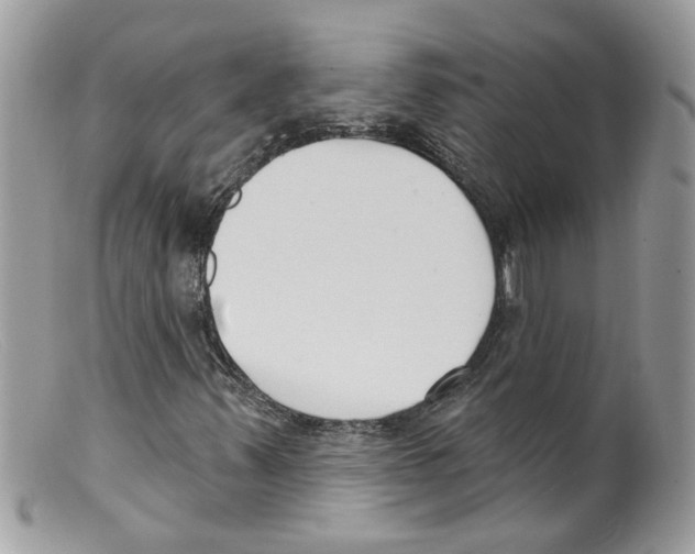 X0000098141347200805151130