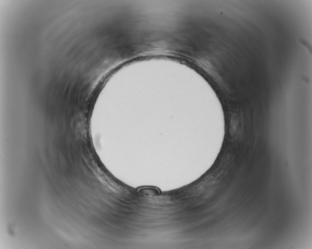 X0000098141356200805151130