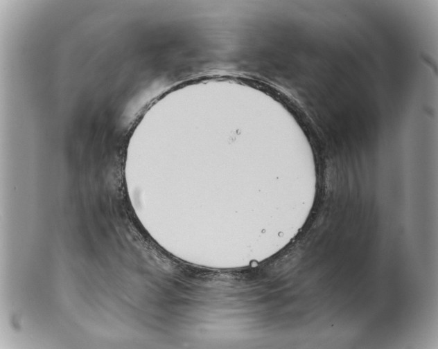 X0000098141359200805151130