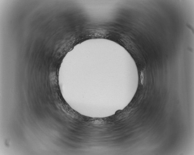 X0000098141395200805151128