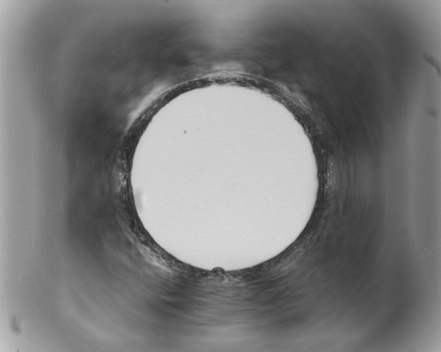 X0000098141400200805151128