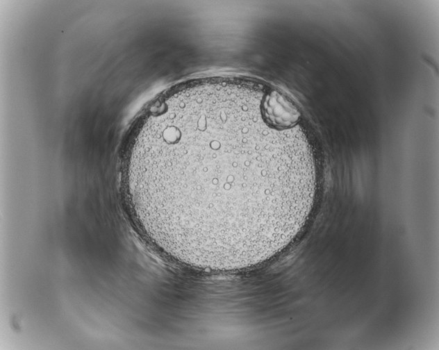 X0000098141406200805151128