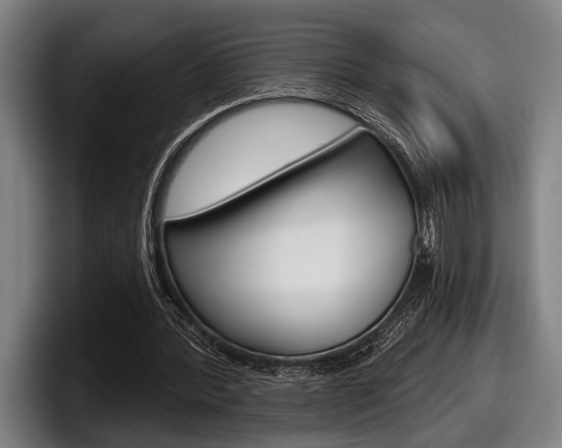 X0000098150388200804171201