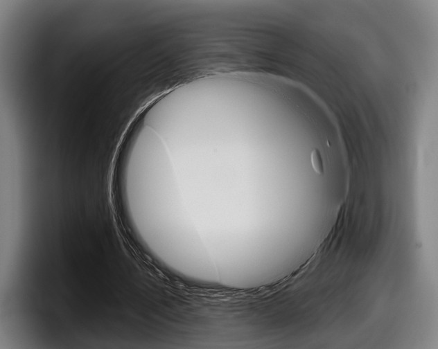 X0000098150579200804171158