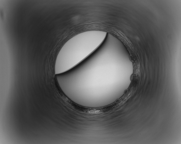 X0000098150669200804171158