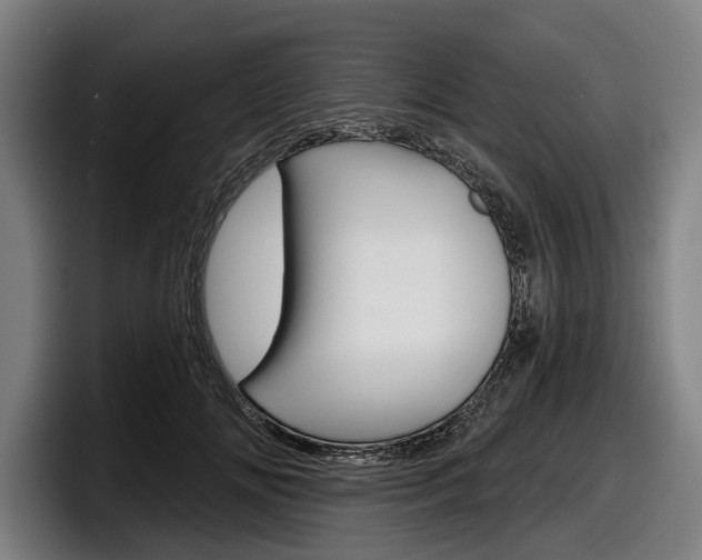 X0000098150702200804171157