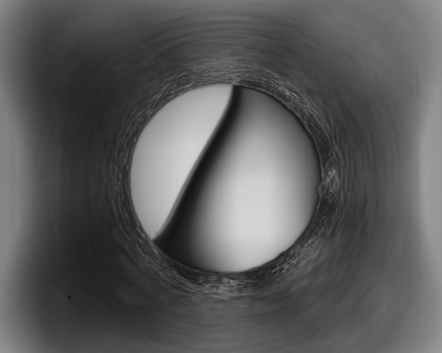 X0000098150772200804171156