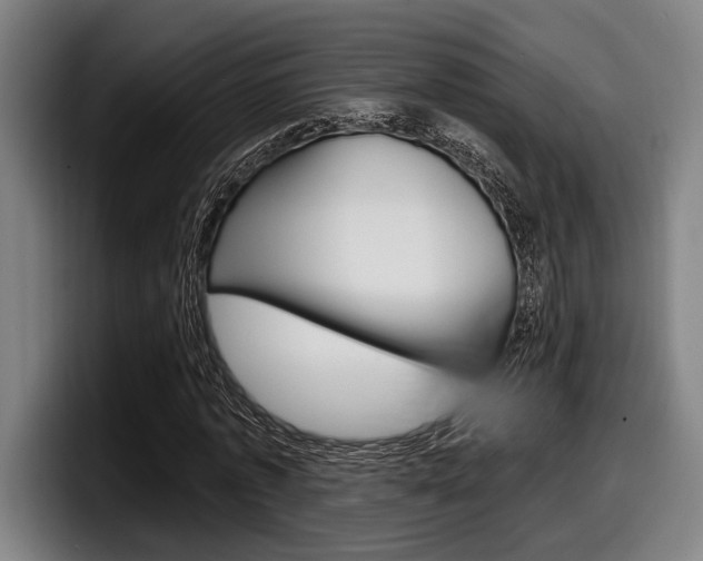 X0000098150773200804171156