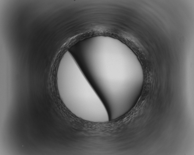X0000098150776200804171156