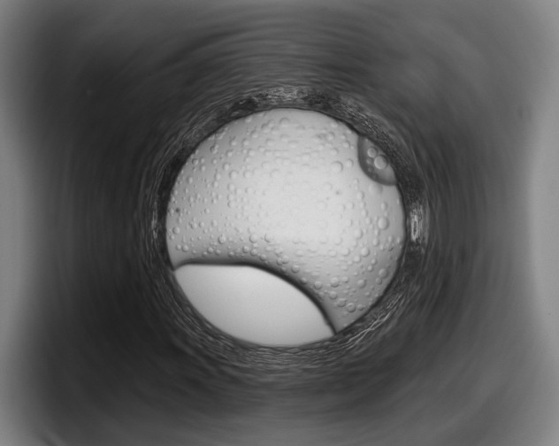 X0000098151011200804171152