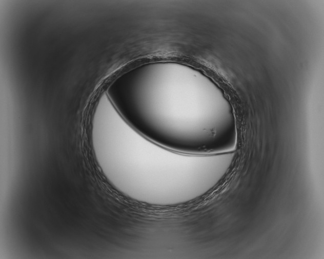 X0000098151160200804171150