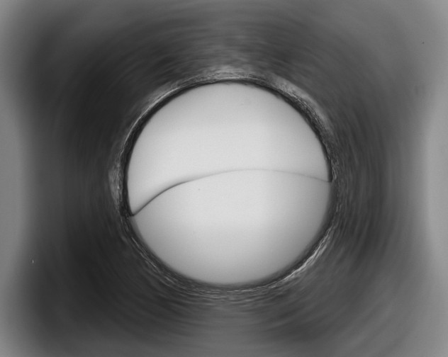X0000098151170200804171150