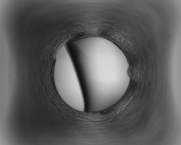 X0000098151201200804171149