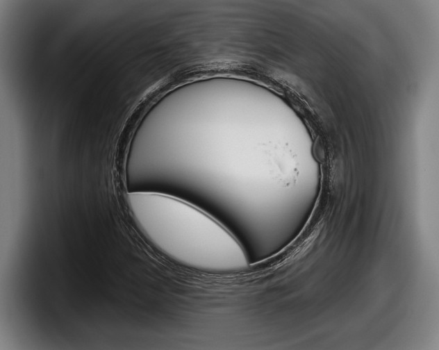 X0000098151210200804171149