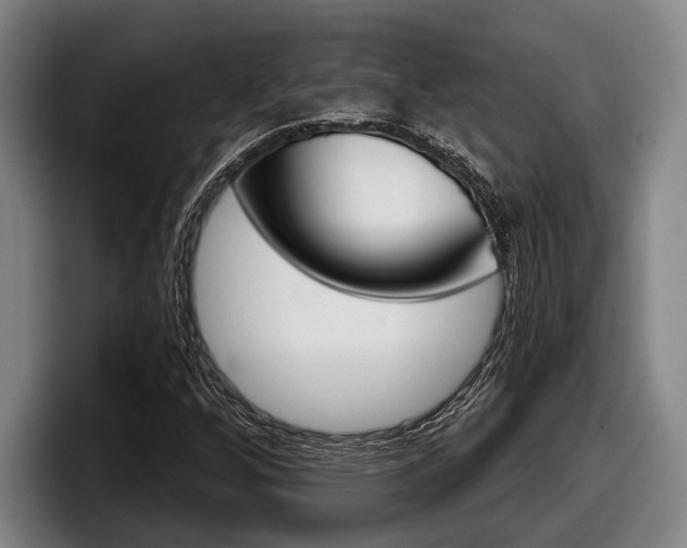 X0000098151256200804171149