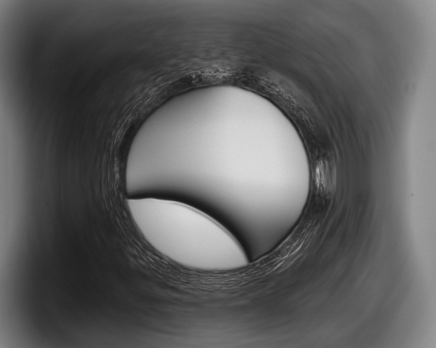 X0000098151299200804171148