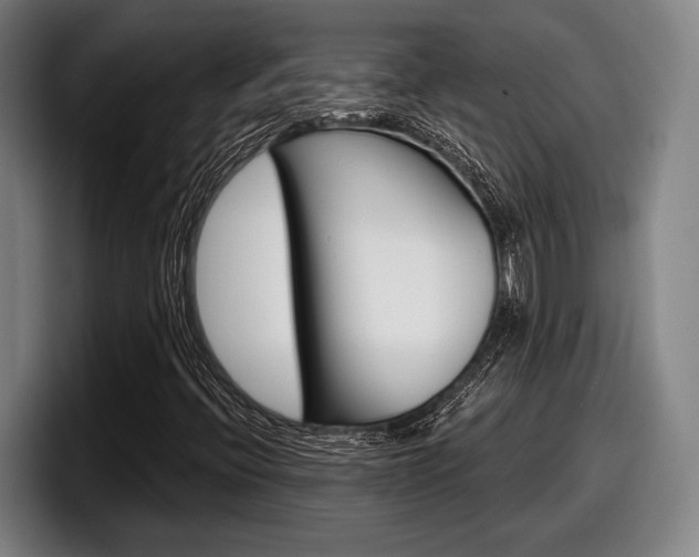 X0000098151396200804171147