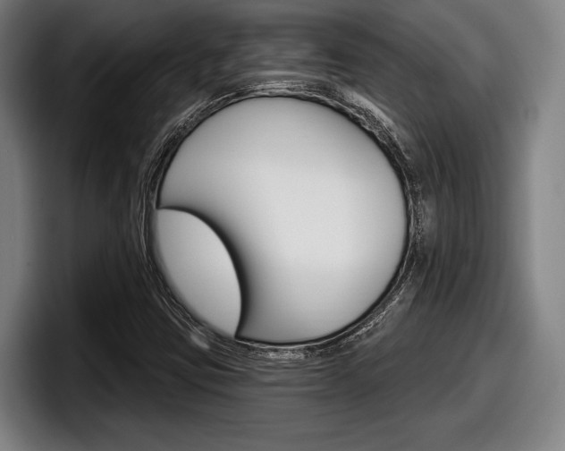 X0000098151403200804171147