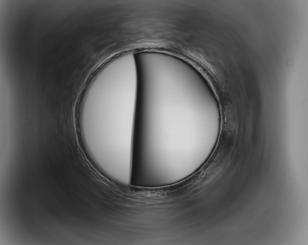 X0000098151404200804171147