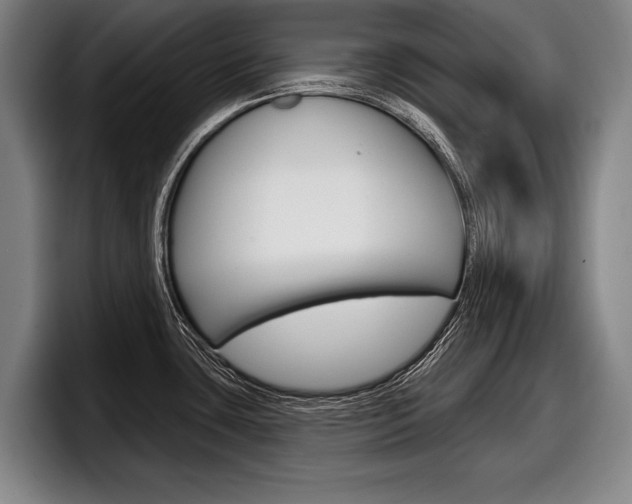 X0000098151435200804171147