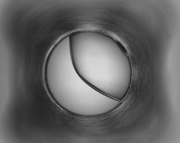 X0000098151477200804171146