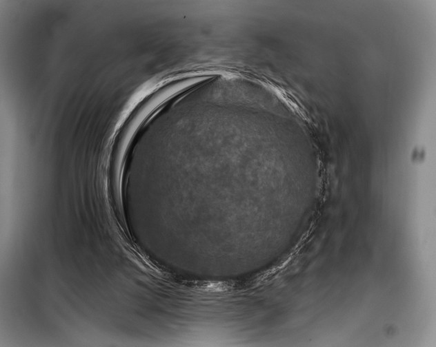 X0000098150056200804171623
