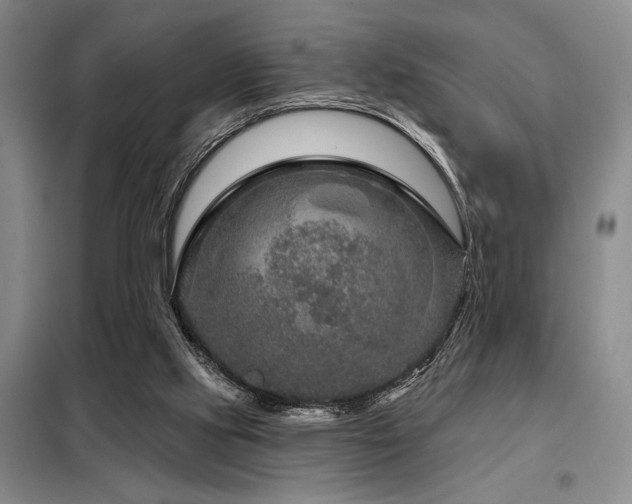 X0000098150061200804171623