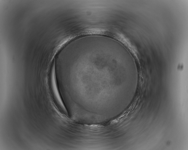 X0000098150107200804171622