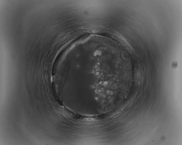 X0000098150169200804171621
