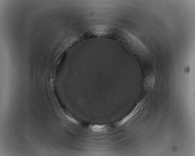 X0000098150180200804171622