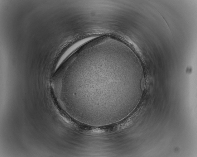 X0000098150257200804171620