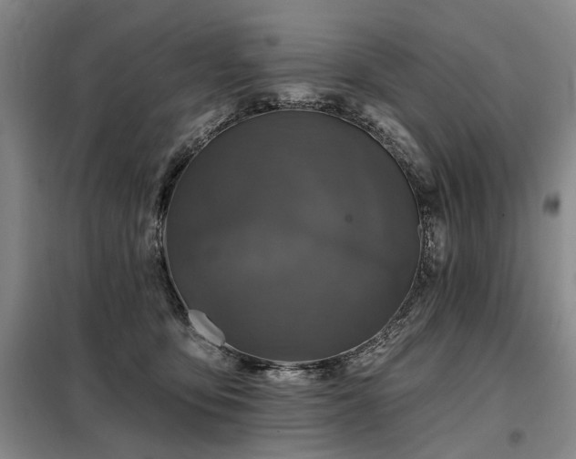 X0000098150419200804171617