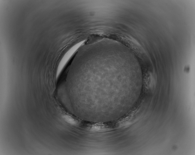 X0000098150420200804171617